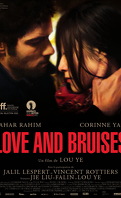 Love and bruises